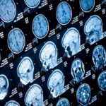 mri-scans-of-brain