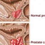 20100224081824-1ec97a38-275x200_c