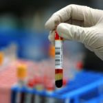 1427965595_Esame-sangue-allergie