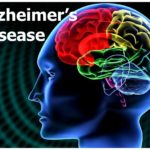alzheimers-disease-management-1-728