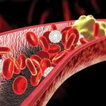 cholesterol
