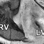 170523081945_1_540x360