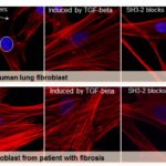 Picture_Fig-5A_D2-e1494942146563