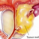 046bff9fca9924763fee848872ded80e