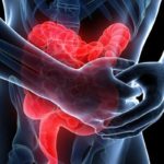 infiammazione-intestinale