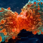 lung-cancer-cell-dividing-article.__v400248237