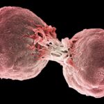 Immune-Therapy-Makes-Headway-Against-a-Lymphoma-RM-722x406