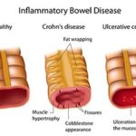 francescoquatraro_Gravida-01