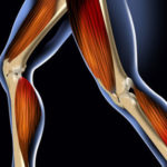 muscle-loss-447x350