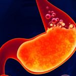 Inibitori-della-pompa-protonica-5