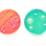 bacteria-in-petri-dish