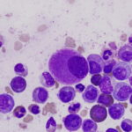 1200px-Hypolobated_small_megakaryocyte