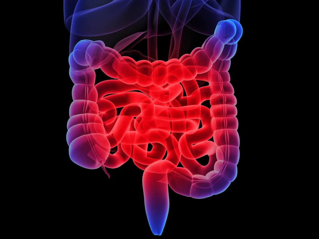 IBD Nuovo Promettente Trattamento MediMagazine ibd-nuovo-promettente-trattamento-medimagazine
