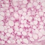 tessuto_Adiposo_figura_3