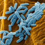 1-pseudomonas-aeruginosa-bacteria-sem-juergen-berger