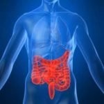 crohns-disease