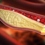 Colesterolo-cause-prevenzione