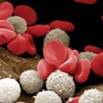 leucemia-0002-kJVE-U431601037115006TQ-593x443@Corriere-Web-Sezioni