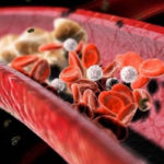malattie-cardiovascolari-e-prevenzione