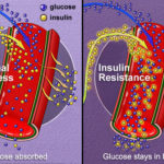 phototake_rm_illustration_of_insulin_absorption