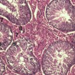 myofibroblast
