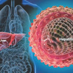 hepatitis-a