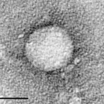 hepatitisc