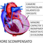 insuffIcienza_cardiaca