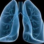 8021190_8000010_immaginefibrosii