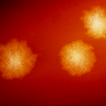 cdifficile (1)