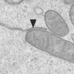 hess_immunity_2018_480x480