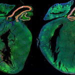 salute-Cuori-iniettati-con-miRNA