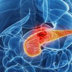 160025008-55a40bba-06f4-4c76-ac03-64d5f0eb78f9