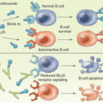 Immunopathogenesis-of-systemic-lupus-erythematosus-Autoantibodies-form-immune-complexes