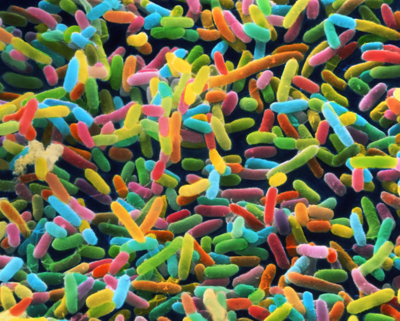 Obesità: microbioma intestinale responsabile di artrite e dolori articolari microbioma intestinale,obesità