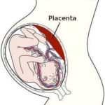 581px-Placenta.svg