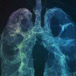 Fibrosi-polmonare-idiopatica-415x260