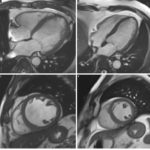 Heart-scan-image--tojpeg_1527249352377_x2