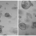 MIT-Stem-Cell-Diet_0