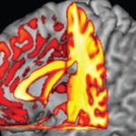 blood-type-cognitive-decline