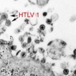 htlv1