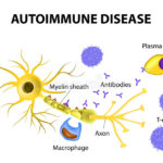 malattia-autoimmune-i-meccanismi-di-danno-di-un-neurone-nel-multipl-50047194
