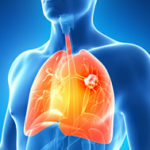 C_17_canaleCittadino_183_paragrafi_paragrafo_0_immagine