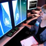 breast-denisty