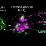 stress-granuels-neurology-neurosciencenews