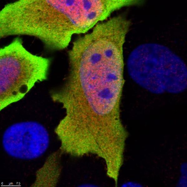 Identificata la funzione di un nuovo gene nella risposta immunitaria risposta immunitaria