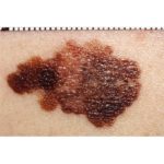 03880107d61c8ad950bfb1ad12bef69740449b41_large