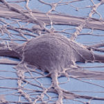 2016_10_12_human_ipsc_derived_neuron_deerinck