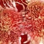 cancro-cellule-tumorali-670x274