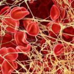 fibrina-e1465918031112